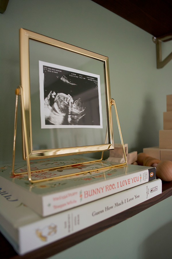 Framed ultrasound photo in a nursery